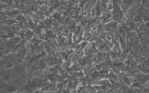 通過直接重新編程制造心肌誘導(dǎo)心肌樣細胞（iCM細胞：induced cardiomyocytes）